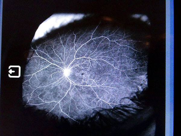 Photo of Lady K's eye scan by Smith